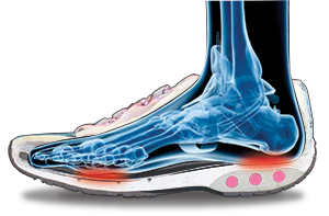 Shock abosorbing wedge for Plantar Fasciitis